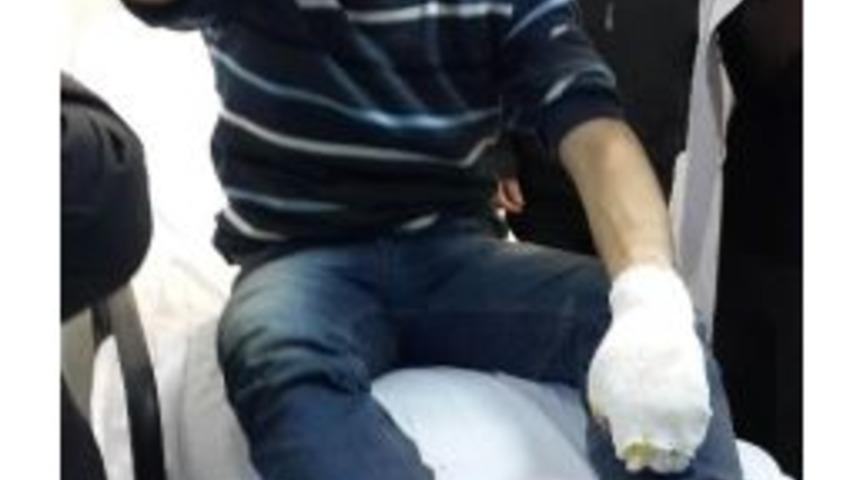 Odun Keserken Patlamada Yaralandı