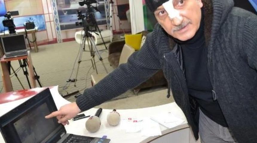 &Ccedil;&ouml;ken &Ccedil;atının Altından Yaralı Kurtulan Esnaf: "filmlerde G&ouml;rd&uuml;ğ&uuml;m Manzarayı Yaşadım"