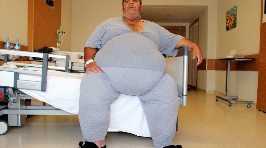 250 Kiloya Ulaşınca, Zayıflamak İ&ccedil;in T&uuml;p Mide Ameliyatı Olmaya Karar Verdi