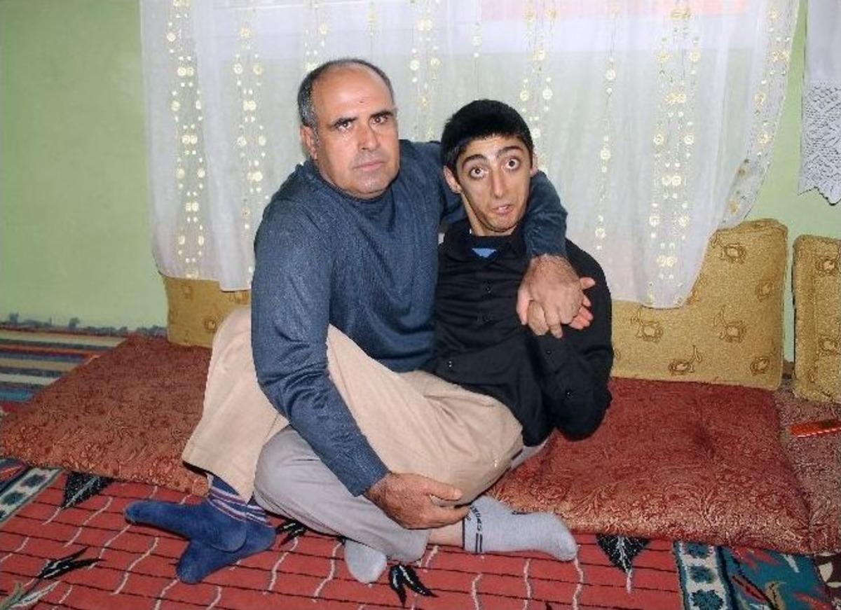 Engelli Abdulhamit&rsquo;in Tek İsteği Ailesine Y&uuml;k Olmamak