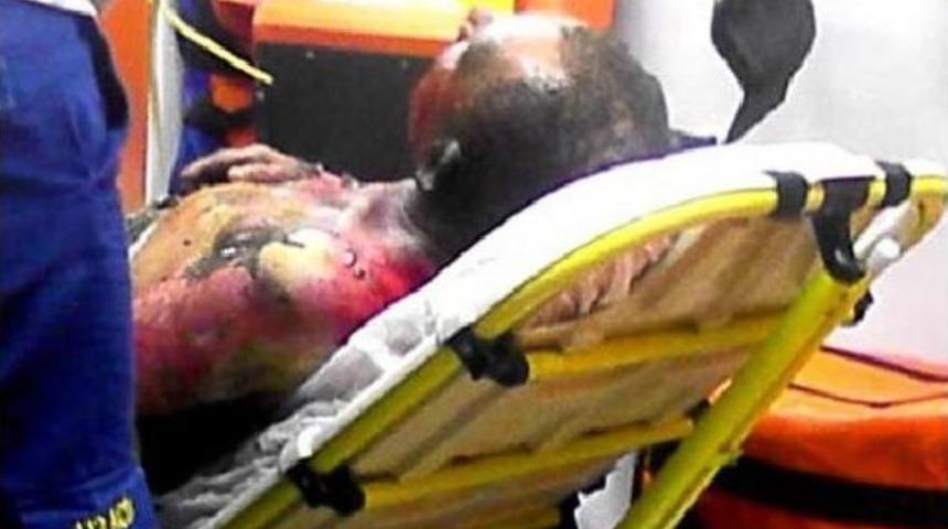 Arızayı Tamir Etmek İsteyen İş&ccedil;i Elektrik Akımına Kapıldı