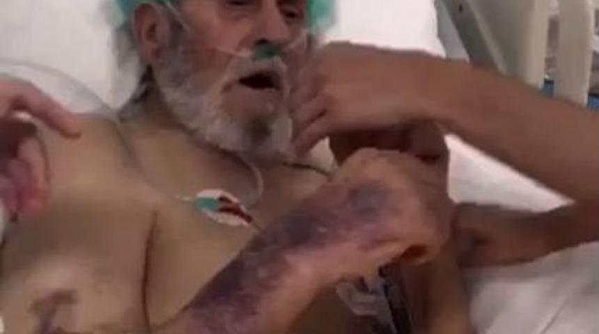 Yoğum Bakım Hastasına Sigara Verip, Dalga Ge&ccedil;tiler