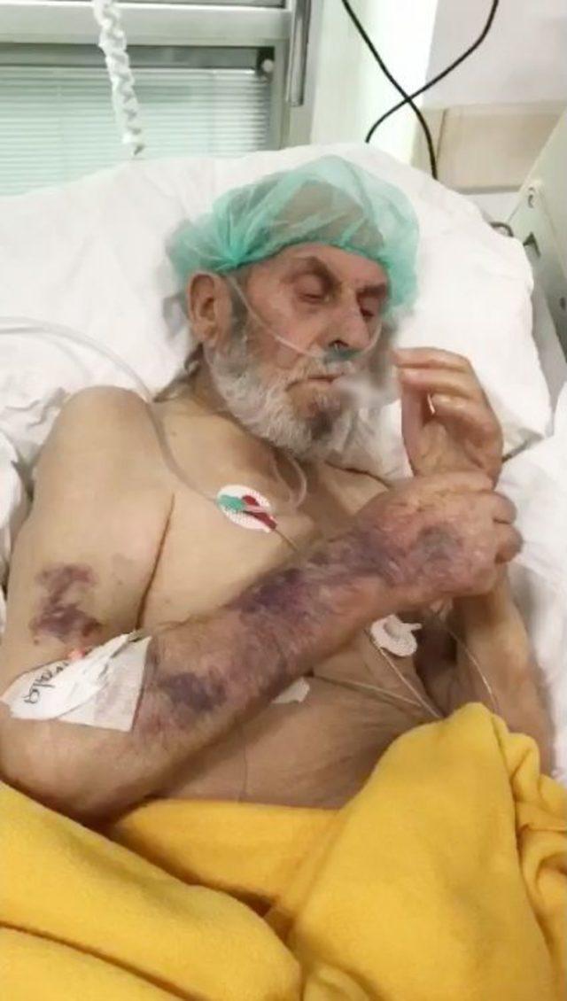 Yoğum Bakım Hastasına Sigara Verip, Dalga Ge&ccedil;tiler 1