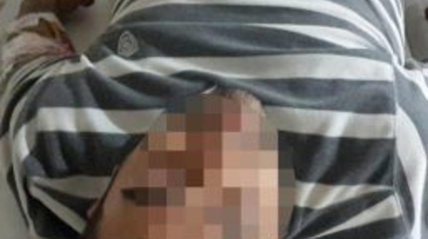 Samsun&rsquo;da Silahlı Saldırı: 2 Yaralı