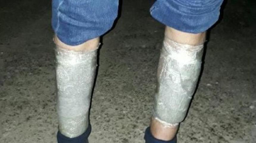 Yarım Kilo Esrarı Bacaklarına Sarmış