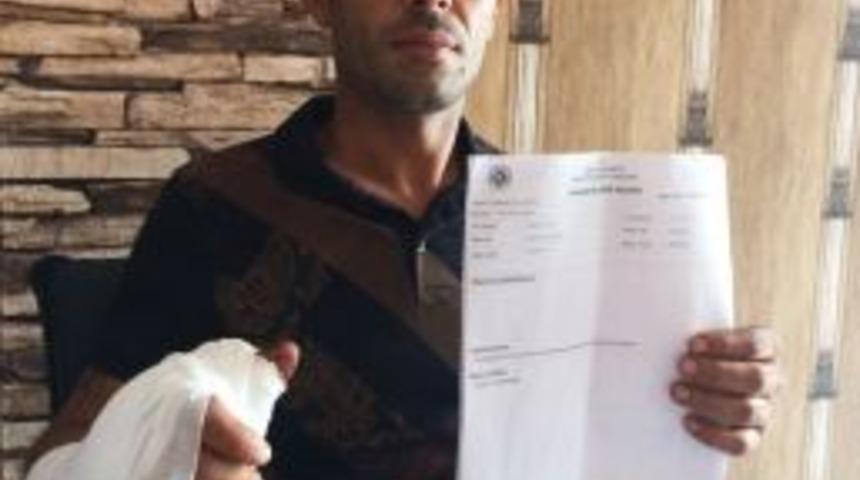 Alkol Şişesi Elinde Patladı