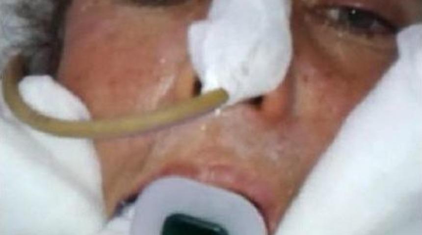 YANLIŞ İLA&Ccedil; KOMALIK ETTİ İDDİASI