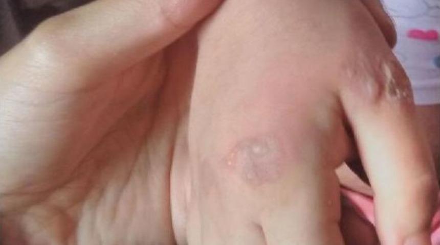 Fatih'te 5 Yaşındaki &Ccedil;ocuğa Işkence Iddiası