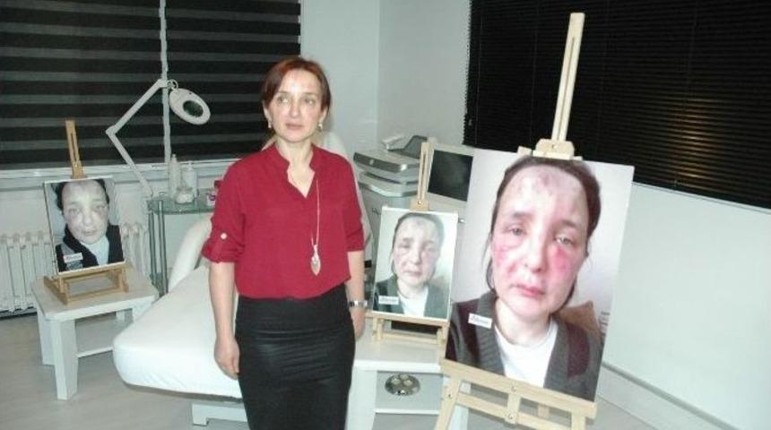 Sahte Doktor Kurbanı Kadının Yüzünde Şaşırtan Değişim