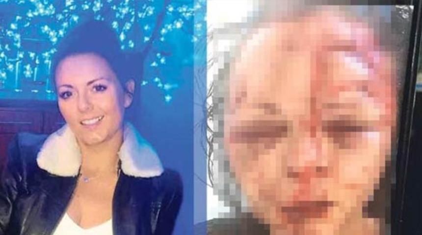 Marmaris'te dehşet! 'Birlikte olmak istiyorum' teklifini reddedince öldüresiye dövdü