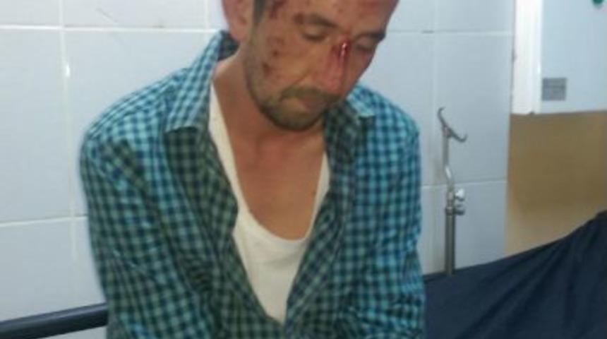 DUR İHTARINA UYMAYAN S&Uuml;R&Uuml;C&Uuml; KA&Ccedil;ARKEN 2 POLİSİN YARALANMASINA NEDEN OLDU