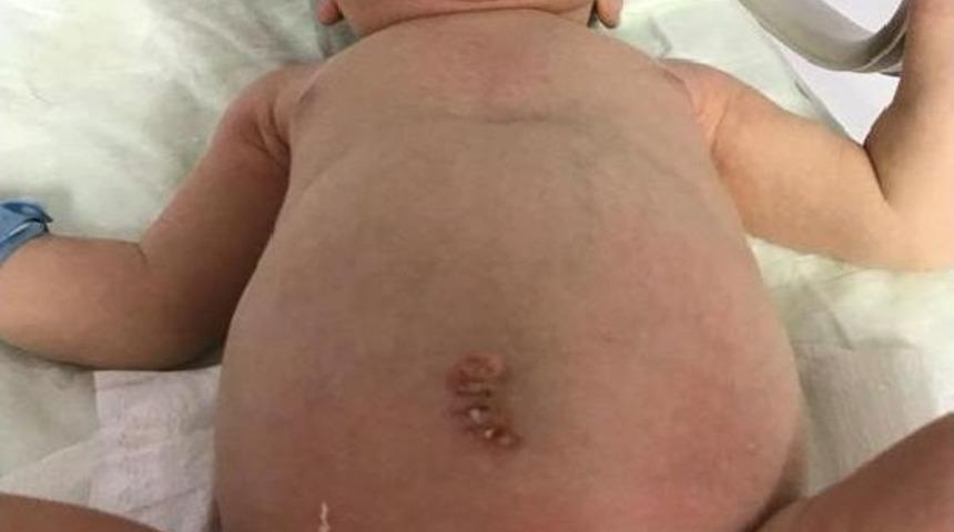 2 G&uuml;nl&uuml;k Bebeğe Ameliyat