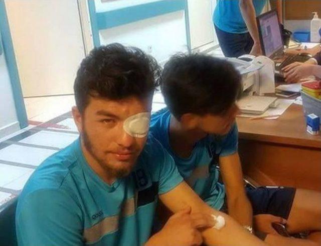 Takım Otobüsüne Taşlı Saldırıda 5 Futbolcu Yaralandı