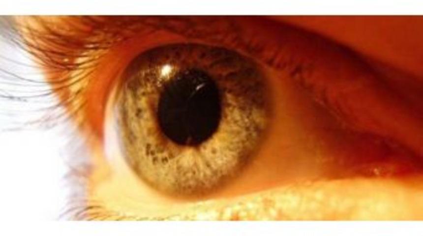 Sarı Nokta Hastalığı G&ouml;rme Kaybı Sebebi