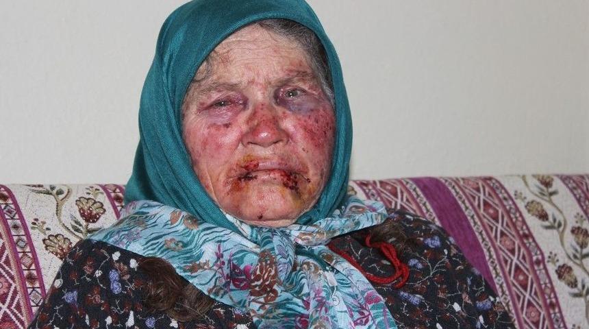 Yaşlı Kadını Darp Ederek Gasp Etme İle İlgili 3 Kişi G&ouml;zaltına Alındı