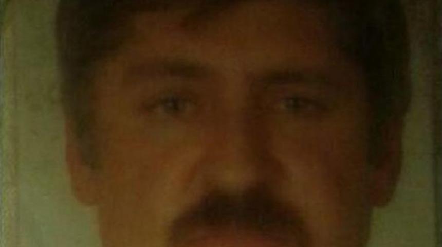 Eski Eşini &Ouml;ld&uuml;r&uuml;p Intihara Kalkışan Aş&ccedil;ıya Estetik Ameliyat