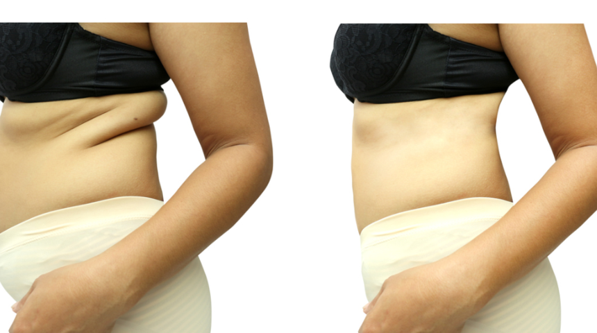 Bir haftada 10 kilo verdiren kardiyolog re&ccedil;etesi