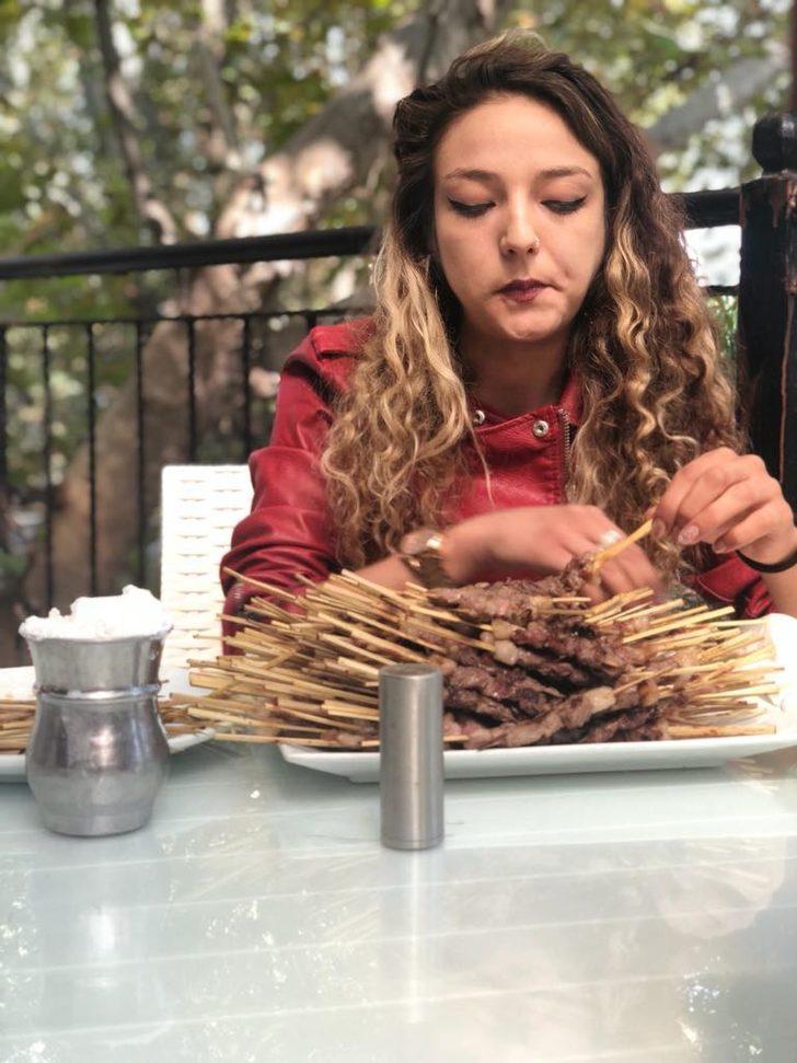 43 kiloluk kadın 290 çöp şiş yedi! G5