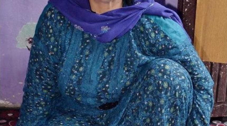 G&ouml;zlerinden biri mavi, diğeri kahverengi