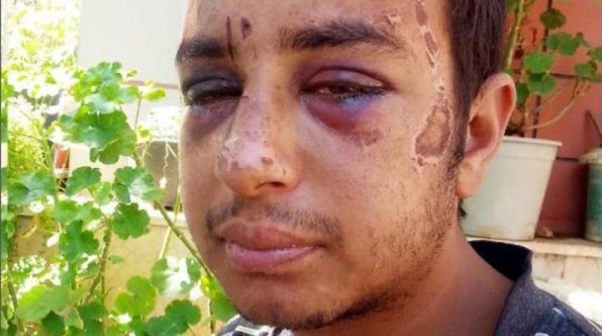 Savcının Takipsizlik Kararına 'gerek&ccedil;e' Itirazı