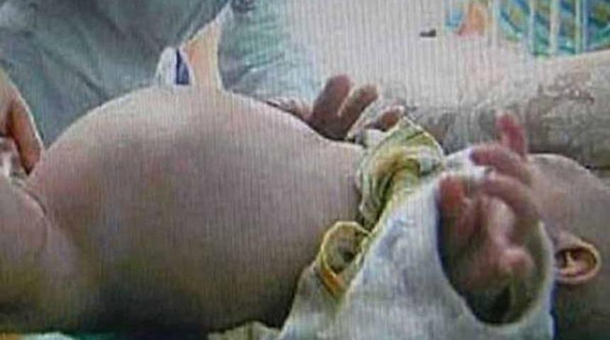 En garip hastalıklar