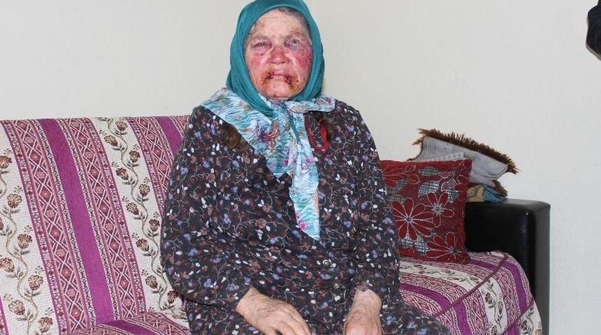 Denizli&rsquo;de Kadının Darp Edilmesinde Kullanılan Bant Ve Bardak Kriminal İncelemeye G&ouml;nderildi