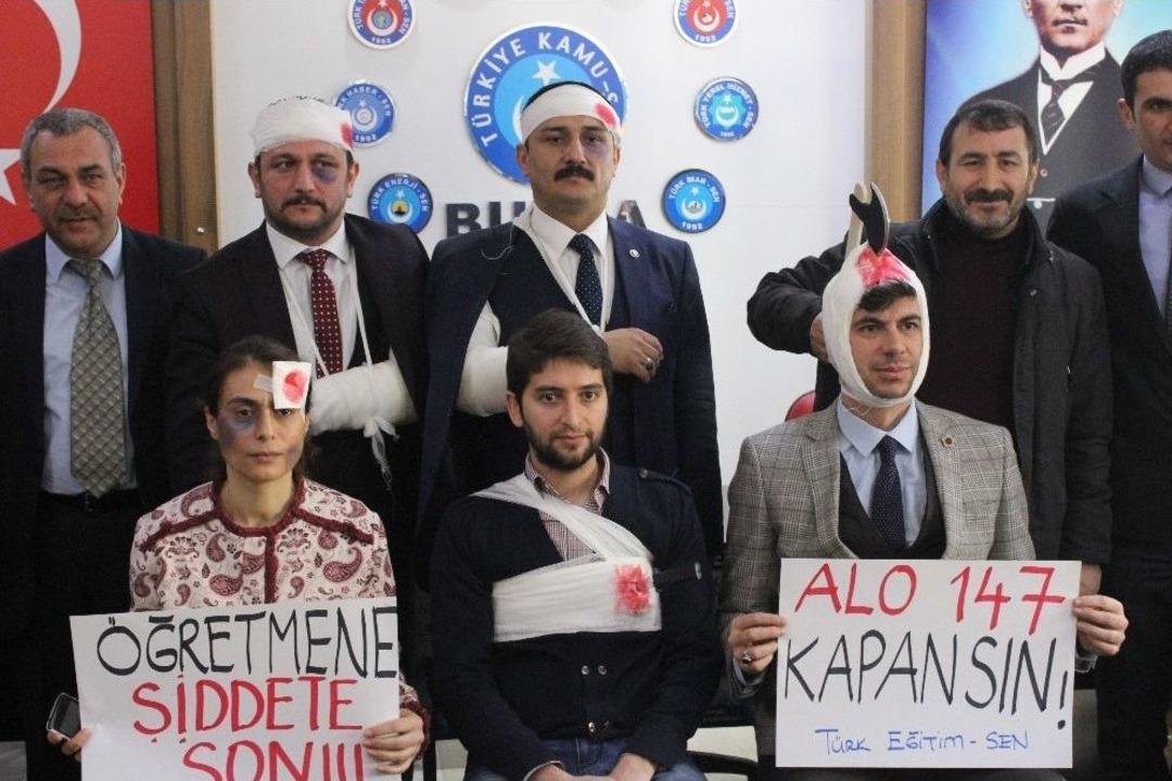 Kalbine Bı&ccedil;ak Saplanan Ve Kafasında Baltayla Gezen &Ouml;ğretmenler Eylem Yaptı