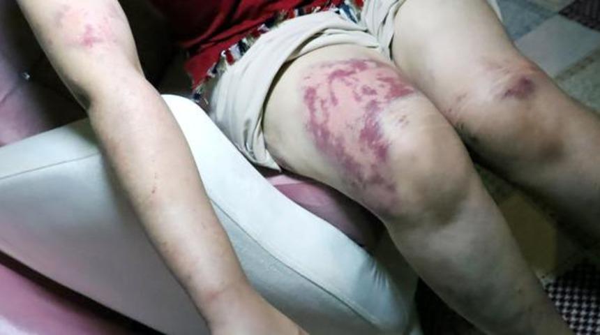 Kayınpederi 9 saat işkence yaptı