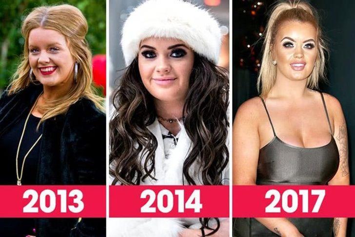 Büyük ikramiyeyi kazandı, tüm parasını estetiğe yatırdı! İşte son hali G4