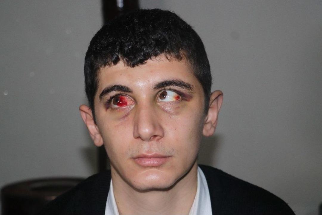 İşitme Engelli Genci Dolmuşta Tekme Tokat D&ouml;vd&uuml;ler