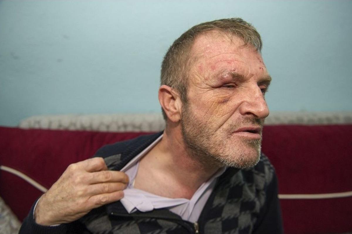 (&ouml;zel Haber) G&ouml;rme Engelli Adamın Ellerini Ve Ayaklarını Bağlayarak Darp Sonra Gasp Ettiler