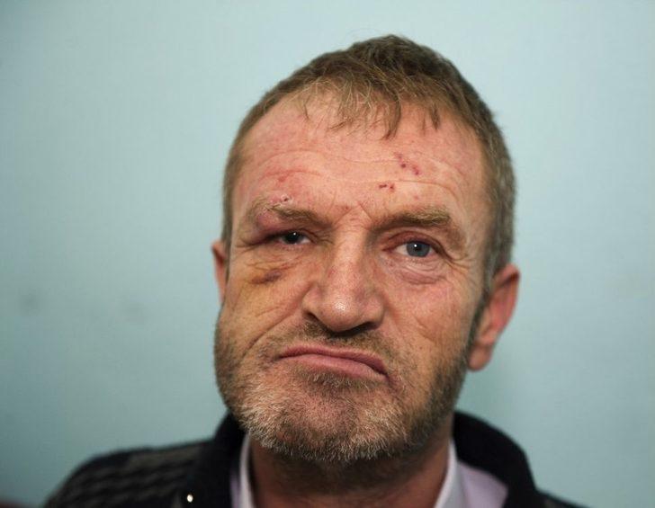 (özel Haber) Görme Engelli Adamın Ellerini Ve Ayaklarını Bağlayarak Darp Sonra Gasp Ettiler G1