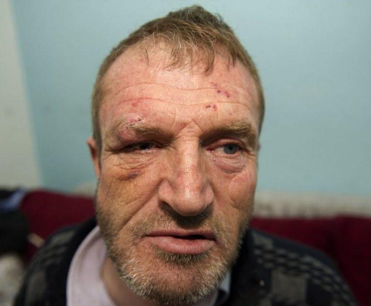 (özel Haber) Görme Engelli Adamın Ellerini Ve Ayaklarını Bağlayarak Darp Sonra Gasp Ettiler G2