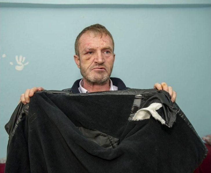 (özel Haber) Görme Engelli Adamın Ellerini Ve Ayaklarını Bağlayarak Darp Sonra Gasp Ettiler G4