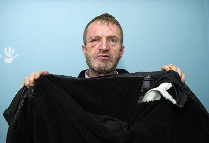 (özel Haber) Görme Engelli Adamın Ellerini Ve Ayaklarını Bağlayarak Darp Sonra Gasp Ettiler G5