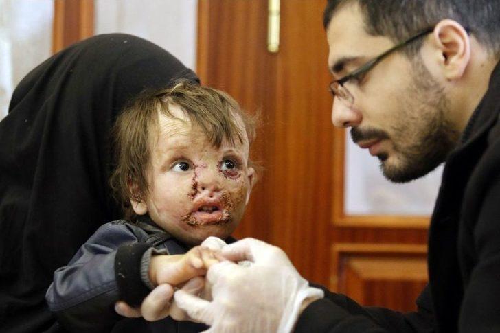 Savaşın Yaktığı Minik Bedenler Antalya’da Hayata Tutundu G3