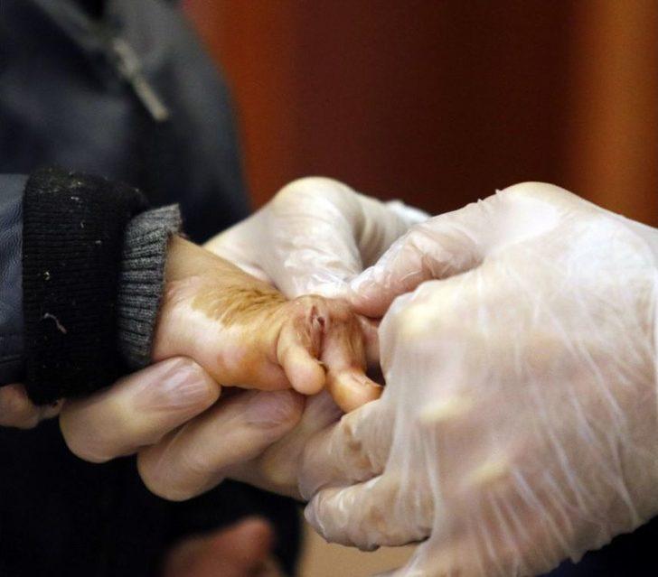 Savaşın Yaktığı Minik Bedenler Antalya’da Hayata Tutundu G4