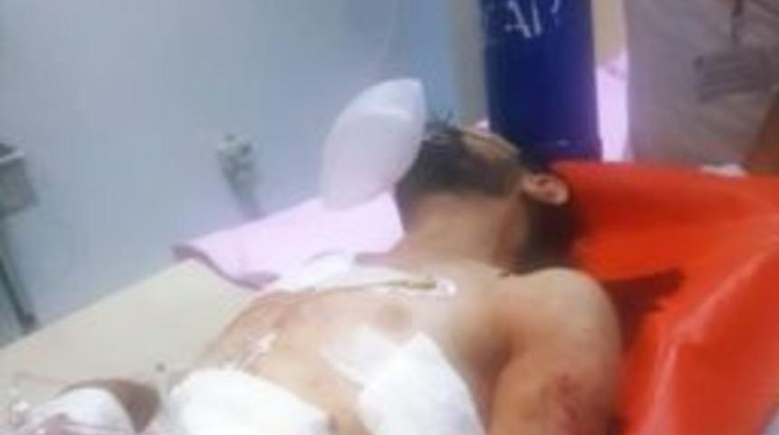 Samsun&rsquo;da Bı&ccedil;aklı Saldırı: 1 Yaralı