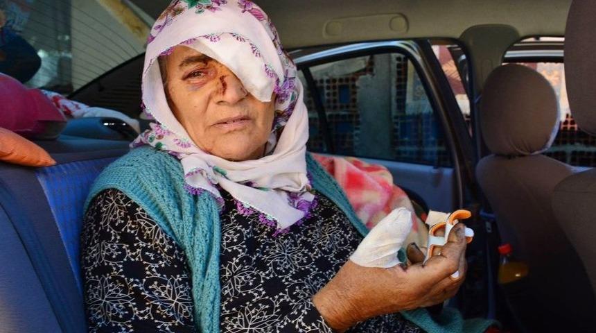 Yaşlı Kadının Bulduğu Kutu Elinde Bomba Gibi Patladı