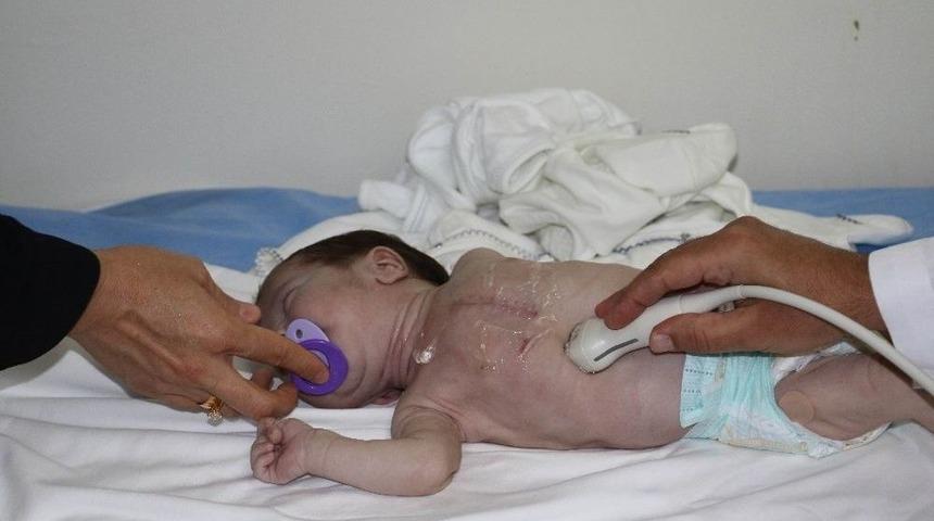 (&ouml;zel) 44 G&uuml;nl&uuml;k Bebeğin Kalbi Sağda Atıyor