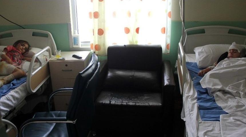 S&uuml;t Kazanına D&uuml;şen 2 &Ccedil;ocuk Yandı