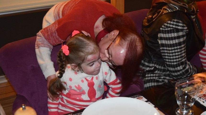 Kelebek Hastaları İle Bir Araya Geldiler