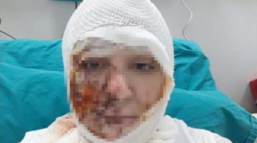 Savcı Itiraz Etti, Kezzaplı Saldırgan G&ouml;zaltına Alındı