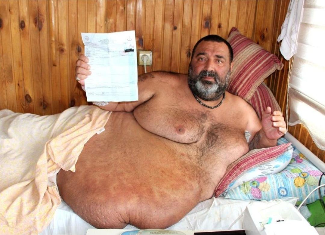 300 Kilo Ağırlığında Yataktan Kalkamıyor