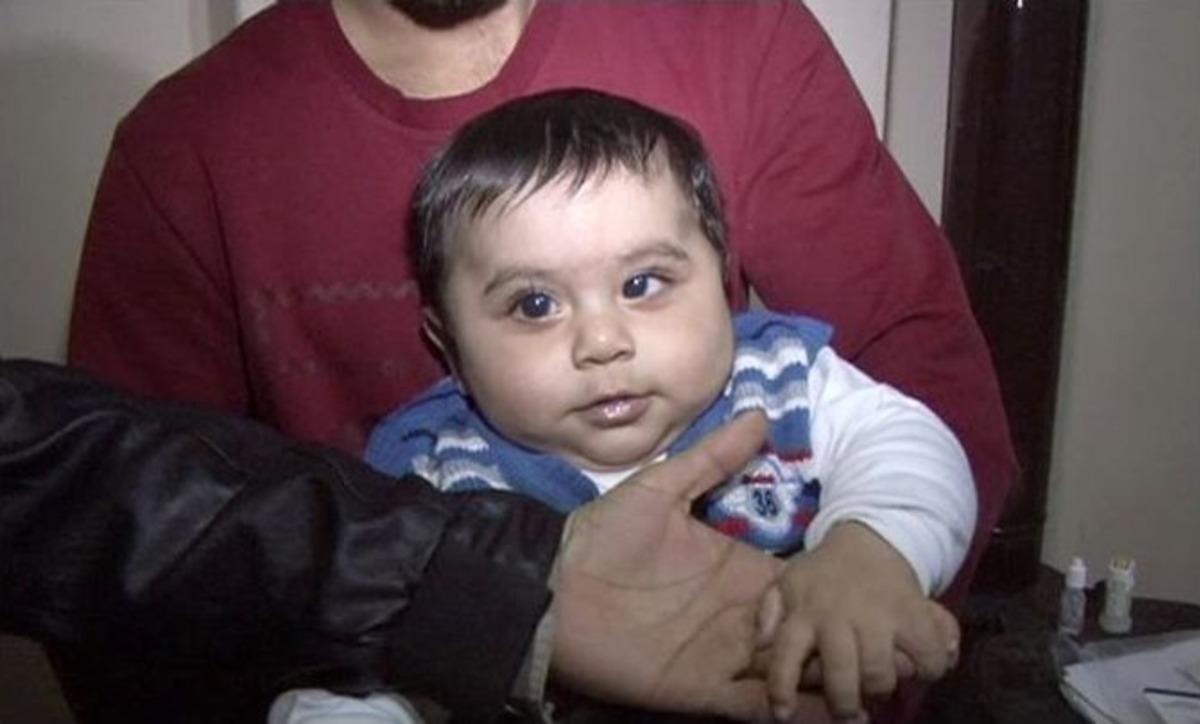 (&ouml;zel Haber) Suriyeli Bebek 8 Bin Lira Bulunamazsa G&ouml;zlerini Kaybedecek