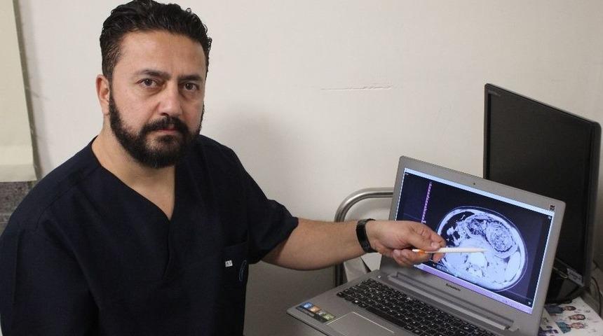 12 Yaşındaki Kızın Midesinden Top B&uuml;y&uuml;kl&uuml;ğ&uuml;nde Sa&ccedil; Ve Sakız Yumağı &Ccedil;ıkarıldı