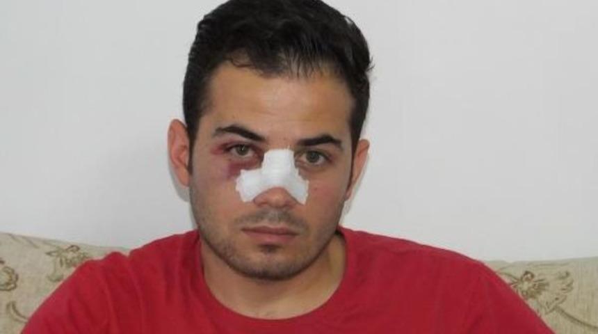 Kirmizi Kart G&ouml;steren Hakemin Burnunu Kirdi