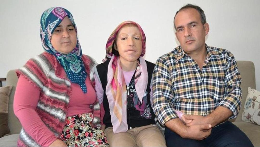 Yeni Bir Y&uuml;z Umuduyla Yaşıyor