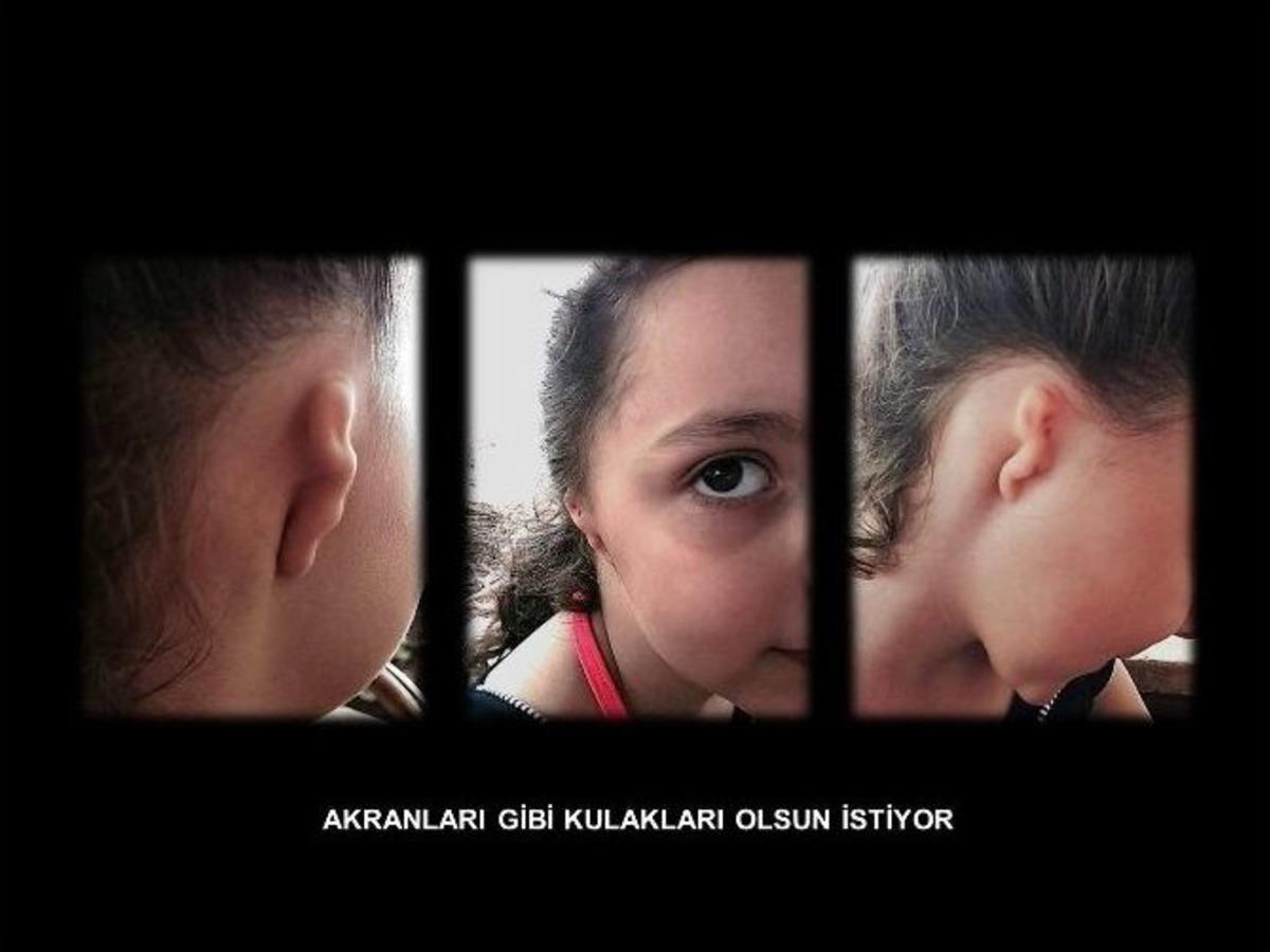 G&ouml;ğ&uuml;s Kafesinden Kulak Yaptı