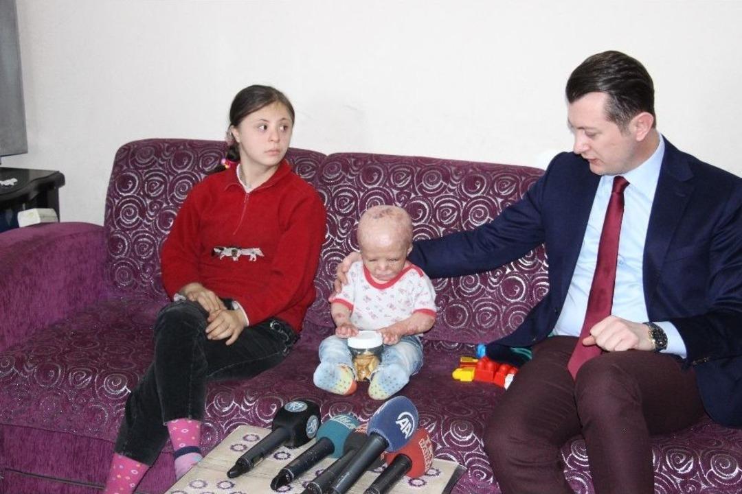 2 Yaşındaki Ahmet&rsquo;in Yaşaması 170 Binin Bulunmasına Bağlı